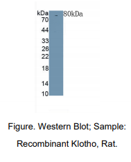 https://msimg.bioon.com/bionline/goods-no-pic.png