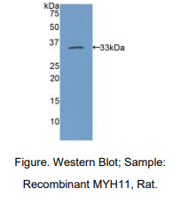 https://msimg.bioon.com/bionline/goods-no-pic.png