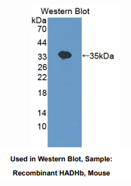 小鼠羟烷基辅酶A脱氢酶β(HADHb)多克隆抗体