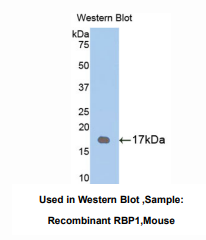 https://msimg.bioon.com/bionline/goods-no-pic.png