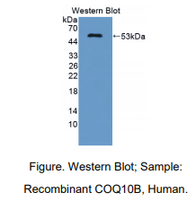 人辅酶Q10同源物B(COQ10B)多克隆抗体