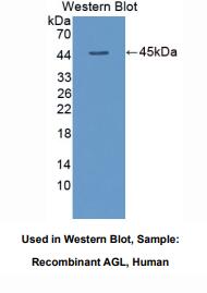 https://msimg.bioon.com/bionline/goods-no-pic.png