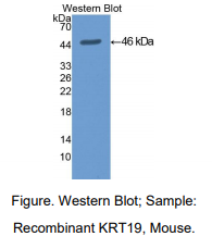 https://msimg.bioon.com/bionline/goods-no-pic.png