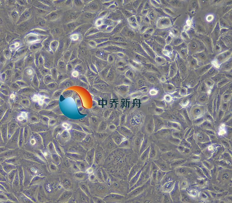 人乳头状肾细胞癌细胞