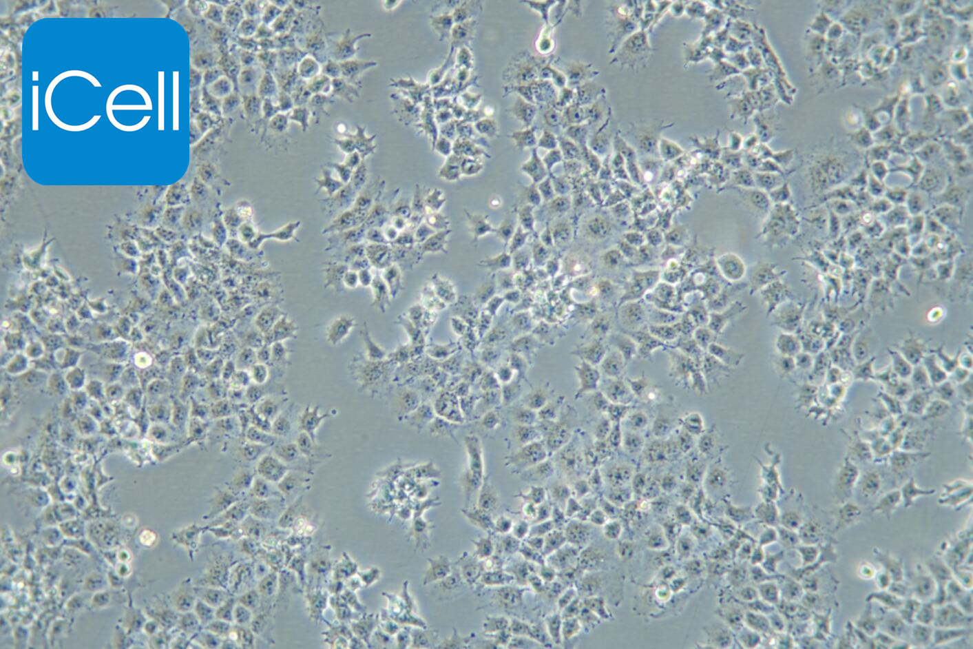 JAR细胞/JAR细胞/人胎盘绒毛癌细胞