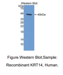 https://msimg.bioon.com/bionline/goods-no-pic.png