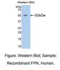 https://msimg.bioon.com/bionline/goods-no-pic.png