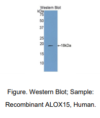 人花生四烯酸-15-脂加氧酶(ALOX15)多克隆抗体