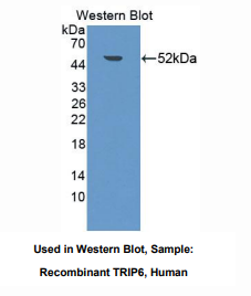 https://msimg.bioon.com/bionline/goods-no-pic.png