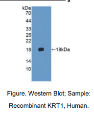人角蛋白1(CK1)多克隆抗体