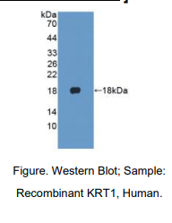 https://msimg.bioon.com/bionline/goods-no-pic.png