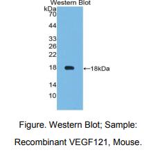 https://msimg.bioon.com/bionline/goods-no-pic.png