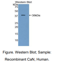 https://msimg.bioon.com/bionline/goods-no-pic.png