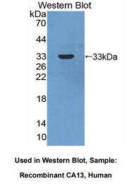 https://msimg.bioon.com/bionline/goods-no-pic.png