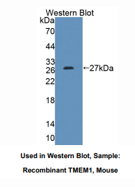 https://msimg.bioon.com/bionline/goods-no-pic.png