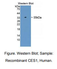 https://msimg.bioon.com/bionline/goods-no-pic.png