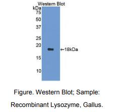 https://msimg.bioon.com/bionline/goods-no-pic.png