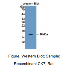 大鼠角蛋白7(CK7)多克隆抗体