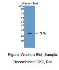 https://msimg.bioon.com/bionline/goods-no-pic.png