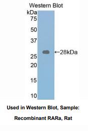 https://msimg.bioon.com/bionline/goods-no-pic.png