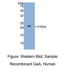 https://msimg.bioon.com/bionline/goods-no-pic.png