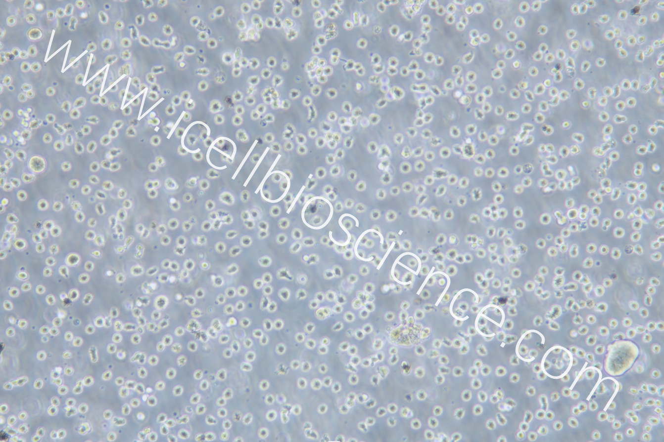 https://img.medsci.cn/5f561f9d1966c8a40c069b97fcac23b82666d7612246dbae75064de0bed04333.png