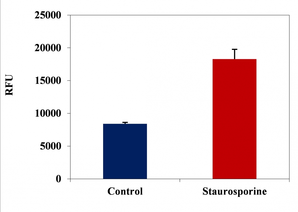 https://img.medsci.cn/e73eefcea40976357f460123cbf1e819c54e5106c9b457225be13b1cbc991aff.png