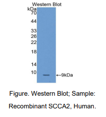 https://msimg.bioon.com/bionline/goods-no-pic.png