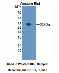 https://msimg.bioon.com/bionline/goods-no-pic.png