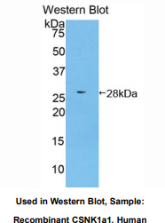 人酪蛋白激酶1α1(CSNK1a1)多克隆抗体