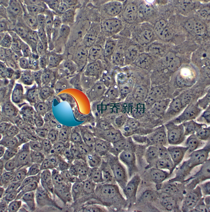 人结肠直肠腺癌细胞