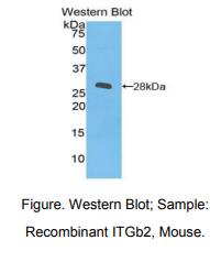 https://msimg.bioon.com/bionline/goods-no-pic.png