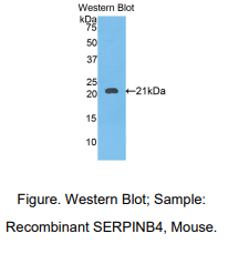 小鼠鳞状细胞癌抗原2(SERPINB4)多克隆抗体