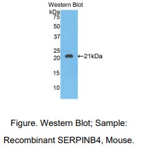 https://msimg.bioon.com/bionline/goods-no-pic.png