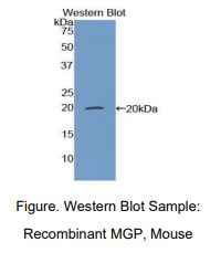 小鼠基质Gla蛋白(MGP)多克隆抗体