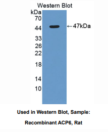 https://msimg.bioon.com/bionline/goods-no-pic.png