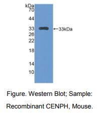 https://msimg.bioon.com/bionline/goods-no-pic.png