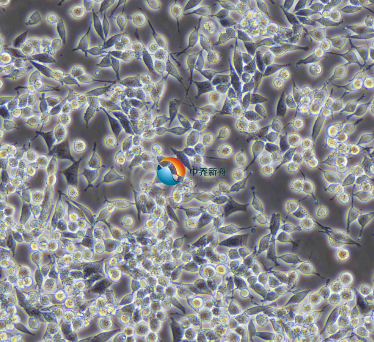 子宫内膜癌细胞