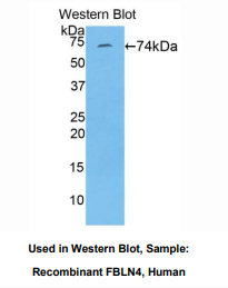 https://msimg.bioon.com/bionline/goods-no-pic.png