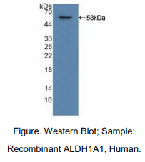 人醛脱氢酶1家族成员A1(ALDH1A1)多克隆抗体