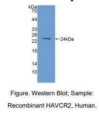 https://msimg.bioon.com/bionline/goods-no-pic.png