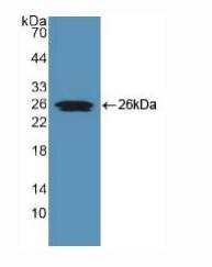 人微小染色体维持缺陷蛋白5(MCM5)多克隆抗体