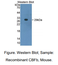 小鼠核心结合因子β亚基(CBFb)多克隆抗体