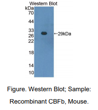 https://msimg.bioon.com/bionline/goods-no-pic.png