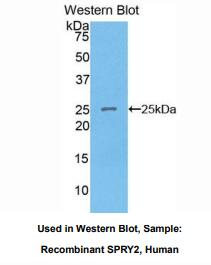 https://msimg.bioon.com/bionline/goods-no-pic.png