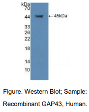 https://msimg.bioon.com/bionline/goods-no-pic.png