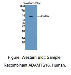 人血小板反应蛋白解整合素金属肽酶16(ADAMTS16)多克隆抗体