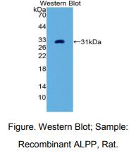 大鼠胎盘碱性磷酸酶(ALPP)多克隆抗体