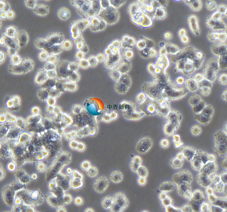 https://img.medsci.cn/8eee53bbc4cb7a98de615e72115896bc4e27fda5cbb764dbd67d9d641c2bb46a.png