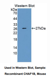 小鼠染色质装配因子1亚基B(CHAF1B)多克隆抗体